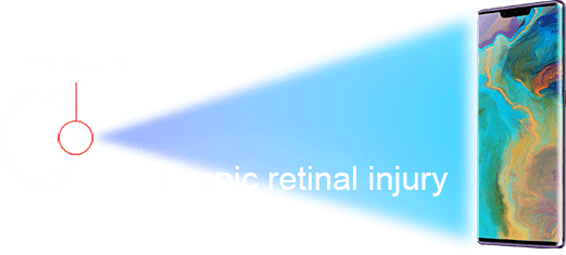 FORWARD Anti-blue Flexible Explosion-proof Film Features-How does blue light hurt our eyes？